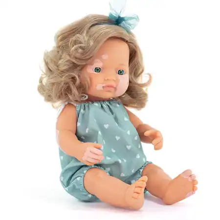 Doll with Vitiligo